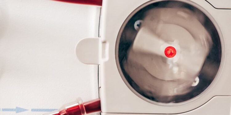 New dialysis machines to be installed in Belgaum