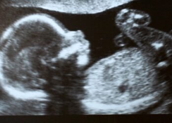 Woman dies in Chikkodi during abortion, body discovered in car in Sangli; three relatives arrested