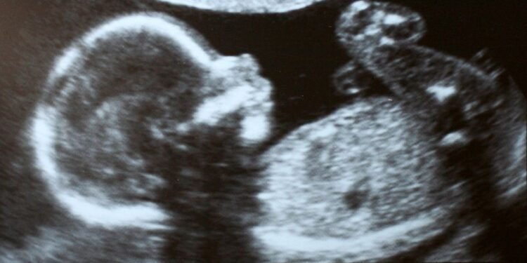 Woman dies in Chikkodi during abortion, body discovered in car in Sangli; three relatives arrested